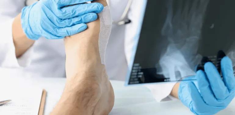 Foot and Ankle Surgery Rehab 3 Best In-home Foot and Ankle Surgery Rehab in Karachi