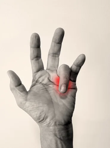 Physiotherapist providing trigger finger physiotherapy treatment at home in Karachi